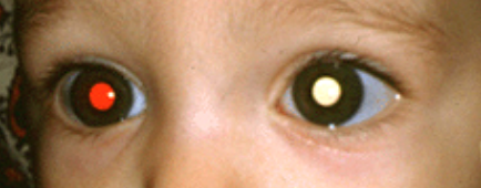 眼眶病,?，斎鹨曆劭?上海眼科醫(yī)院