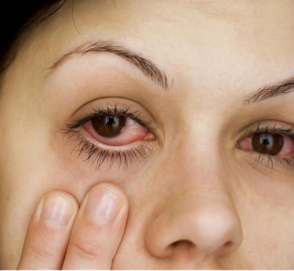 眼表眼角膜,希瑪瑞視眼科,上海眼科醫(yī)院