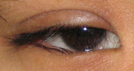 眼眶病,?，斎鹨曆劭?上海眼科醫(yī)院