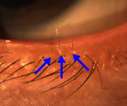 小兒眼病,?，斎鹨曆劭?上海眼科醫(yī)院