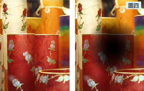 青光眼,希瑪瑞視眼科,上海眼科醫(yī)院