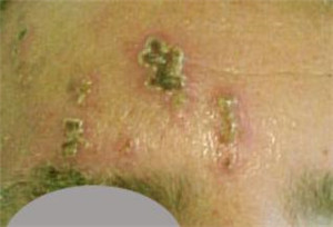 眼表眼角膜,?，斎鹨曆劭?上海眼科醫(yī)院