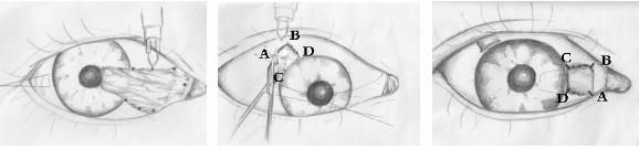 眼表眼角膜,?，斎鹨曆劭?上海眼科醫(yī)院