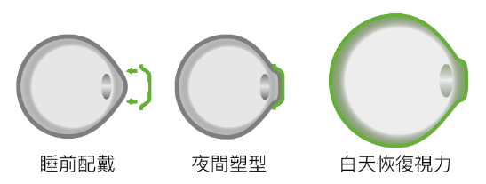 醫(yī)學(xué)驗光配鏡,?，斎鹨曆劭?上海眼科醫(yī)院