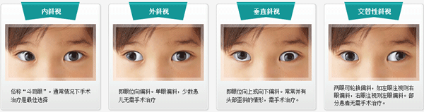 小兒眼病,?，斎鹨曆劭?上海眼科醫(yī)院