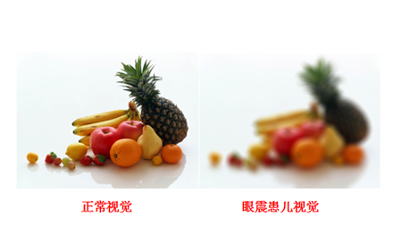 小兒眼病,?，斎鹨曆劭?上海眼科醫(yī)院