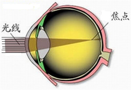 小兒眼病,?，斎鹨曆劭?上海眼科醫(yī)院