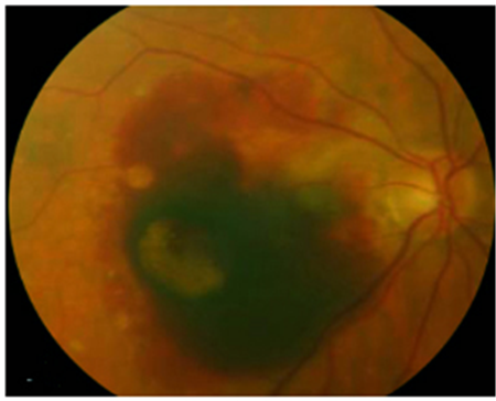 眼表眼角膜,希瑪瑞視眼科,上海眼科醫(yī)院