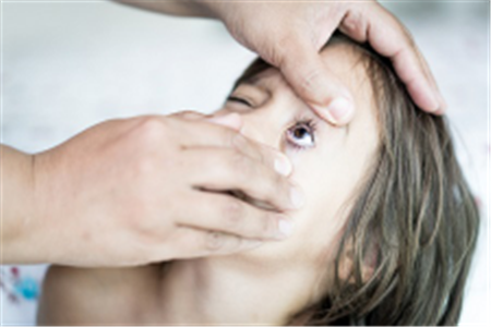 眼表眼角膜,?，斎鹨曆劭?上海眼科醫(yī)院