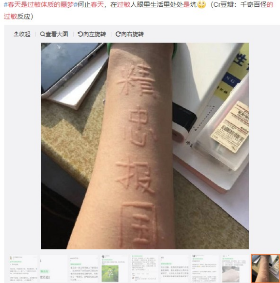 眼表眼角膜,?，斎鹨曆劭?上海眼科醫(yī)院