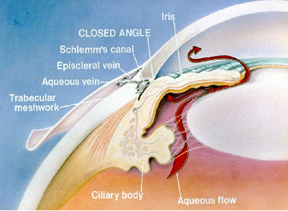 青光眼,?，斎鹨曆劭?上海眼科醫(yī)院