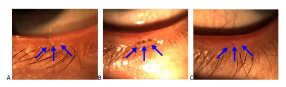 眼眶病,希瑪瑞視眼科,上海眼科醫(yī)院