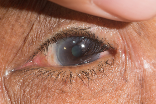 眼眶病,?，斎鹨曆劭?上海眼科醫(yī)院