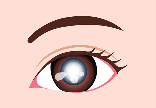 小兒眼病,?，斎鹨曆劭?上海眼科醫(yī)院